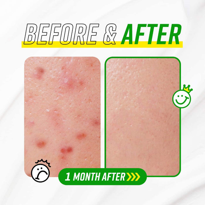 Have A Good Cream Snail & Centella - Korean-Skincare