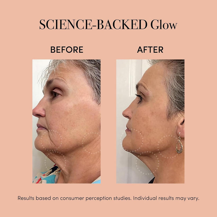 reVive Light Therapy Lux Collection Clinical Device, Anti-Aging and Acne - RVDUO-Single - LL Medico